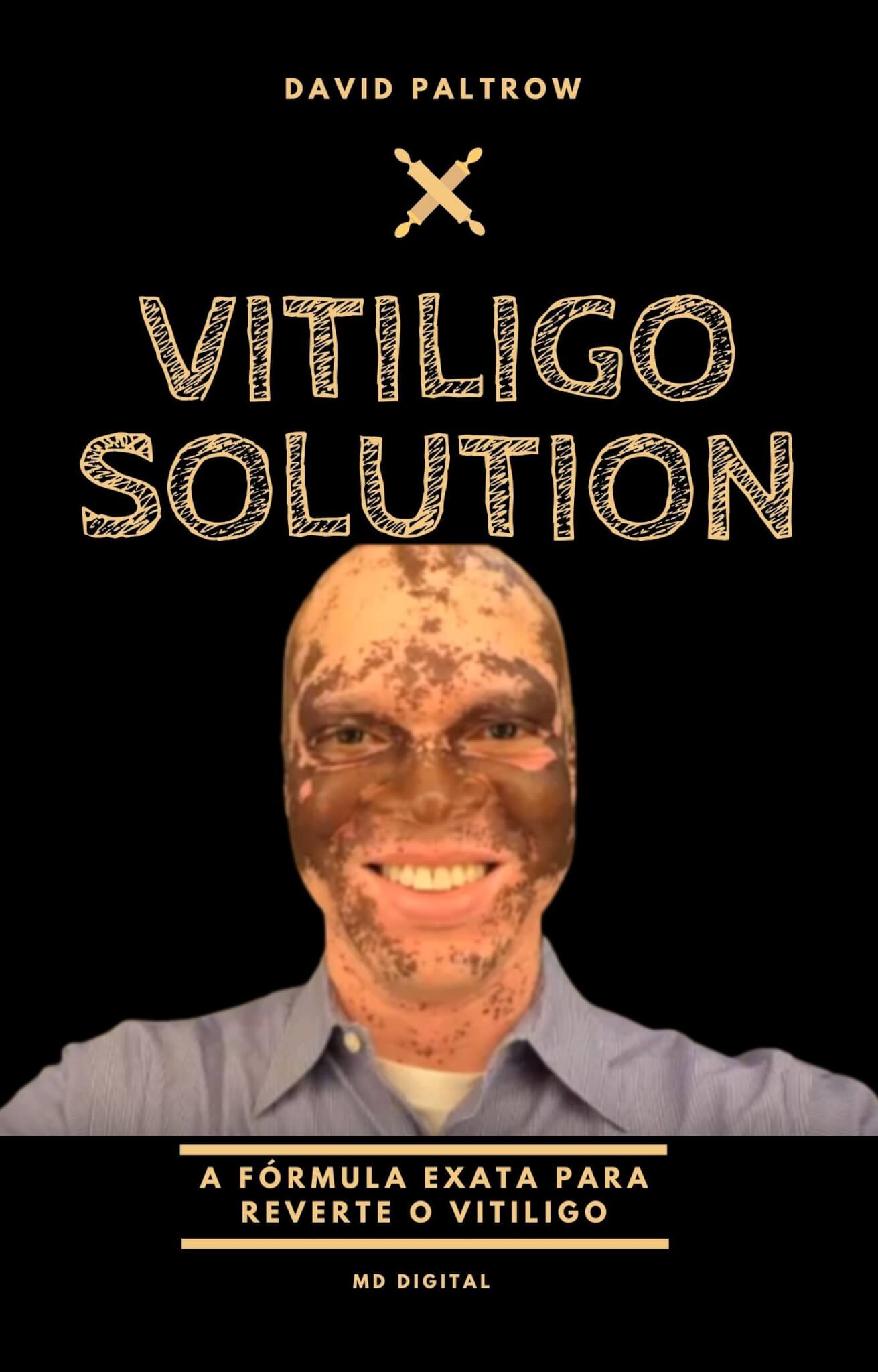 Vitiligo Solution